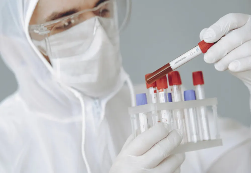 Bilanț CoVid-19, 29 august: 1.365 infectați, 332 vindecați, 32 decedați, 490 internați în ATI! Vezi situația din județul tău