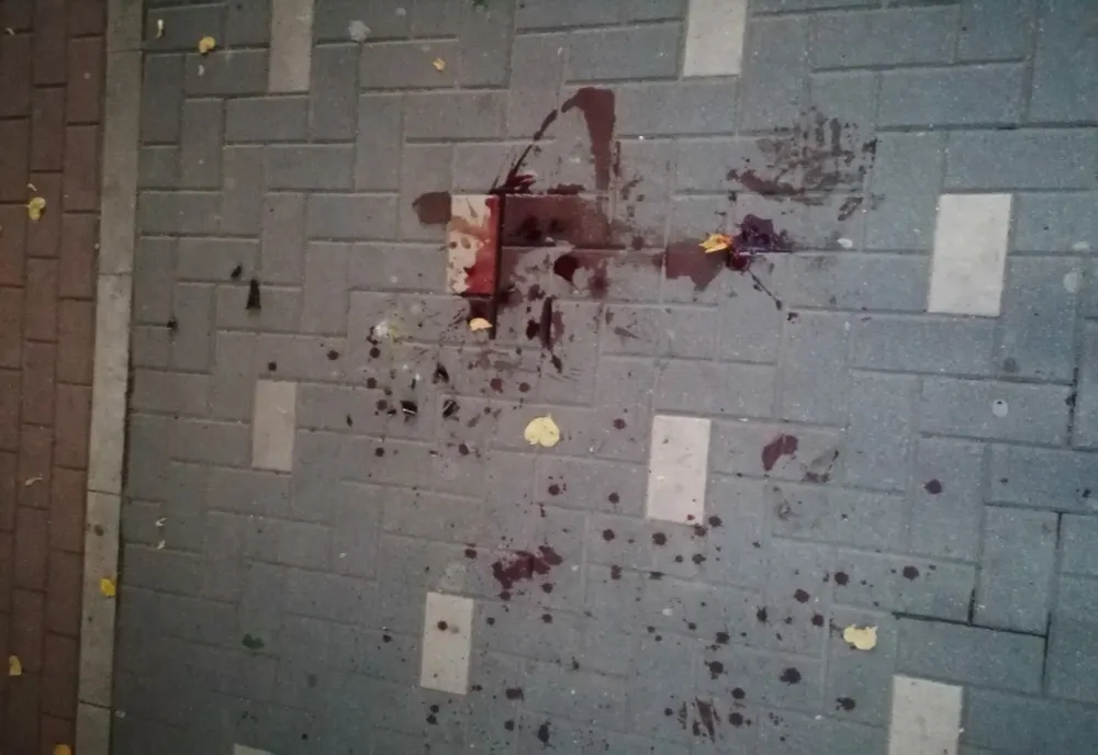 Sălăjean, bătut de doi tineri pe o stradă din zona centrală a Zalăului! Agresorii, dați pe mâna polițiștilor