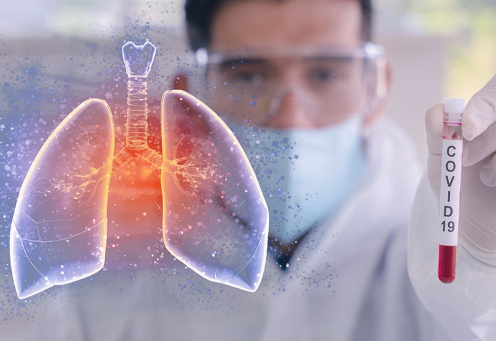 Bilanț CoVid-19: 1.415 cazuri noi, 44 decese, 373 vindecări! În ATI sunt internați 473 de pacienți