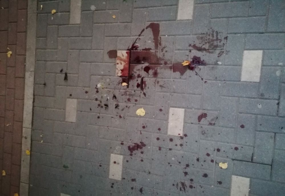 Sălăjean, bătut de doi tineri pe o stradă din zona centrală a Zalăului! Agresorii, dați pe mâna polițiștilor