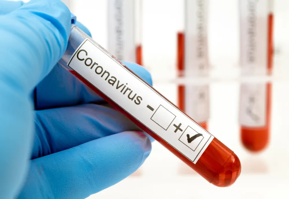 Coronavirus, situaţia la zi în judeţul Sălaj. Niciun caz nou