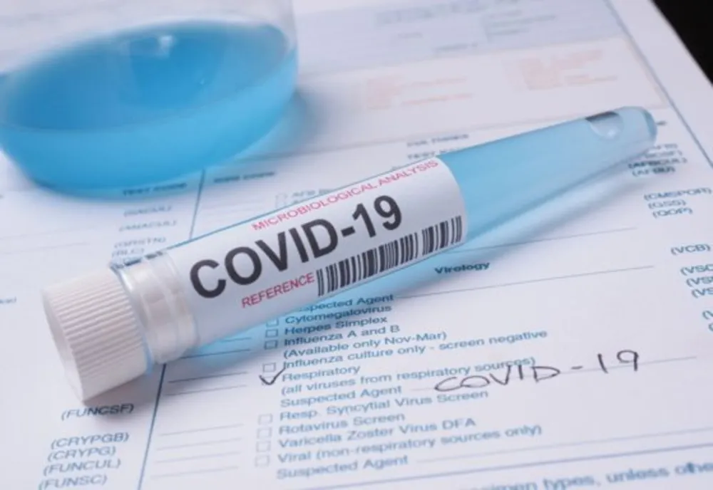 COVID-19: 88 de sălăjeni s-au vindecat