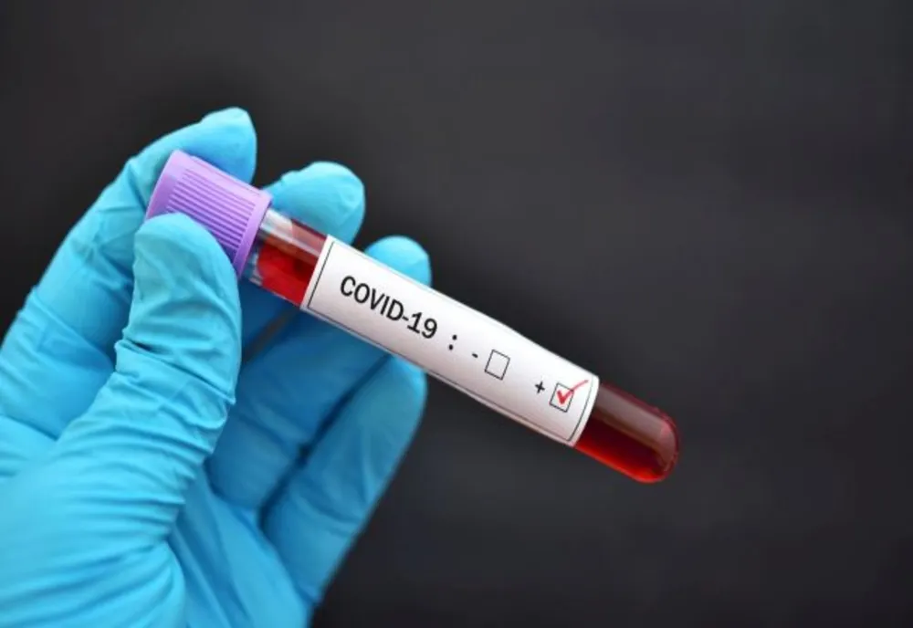 Bilanț CoVid-19: 1.014 cazuri noi, 45 de decese, 479 pacienți în ATI