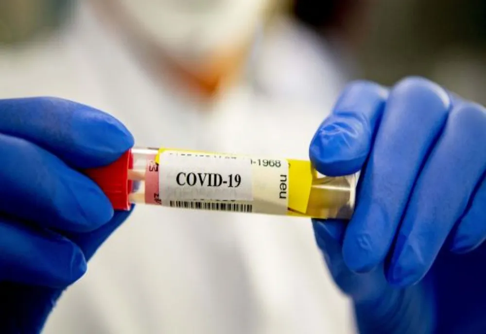 Bilanț coronavirus 30 decembrie: 1.497 cazuri noi și 37 de decese dintre care 1 anterior