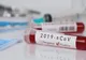 A fost înregistrat cel de-al treilea deces din cauza CoVid-19, în România! Teoretic, bărbatul nu a intrat în contact cu vreo persoană infectată și nici nu a călătorit