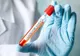 Ministrul Sănătății anunță un program amplu de testare națională anti-coronavirus, de la 1 iunie